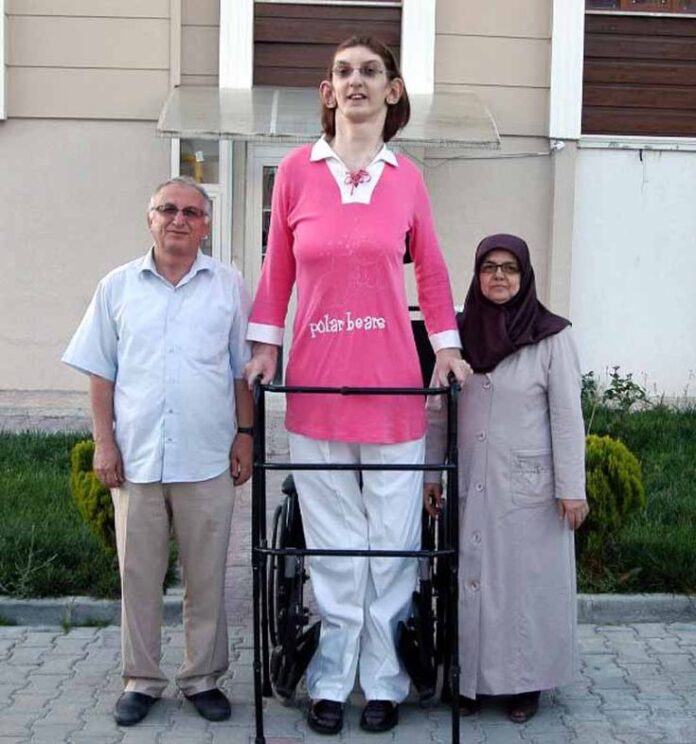 Rumeysa_gelgi_turca_la_piu_alta_donna_al_mondo