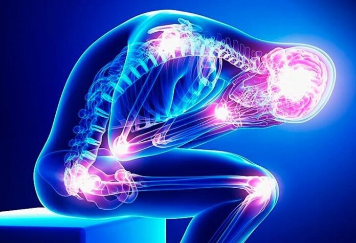 fibromialgia